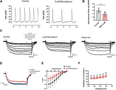 Electrophysiological and sick sinus syndrome effects of Remdesivir challenge in guinea-pig hearts